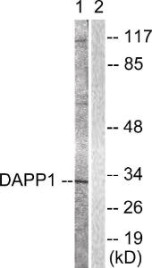 Anti-DAPP1 antibody