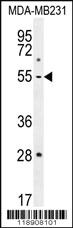 Anti-MMP1 Rabbit Polyclonal Antibody