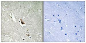 Immunohistochemical analysis of paraffin-embedded human brain using Anti-MAP3K7 (phospho Ser439) Antibody. The right hand panel represents a negative control, where the antibody was pre-incubated with the immunising peptide.