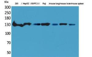 Western blot analysis of 293, HepG BXPC 3, Raji, mouse lung, mouse brain, mouse spleen cells using Anti-IL16 Antibody