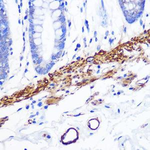 Immunohistochemistry analysis of paraffin-embedded human colon tissue using Anti-Desmin Antibody [ARC0235] (A305689) at a dilution of 1:100 (40X lens). Perform microwave antigen retrieval with 10 mM PBS buffer pH 7.2 before commencing with IHC staining protocol