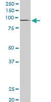 Anti-PML Mouse Monoclonal Antibody [clone: 2B10]