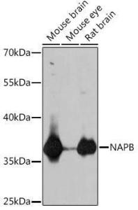 Western blot analysis of extracts of various cell lines, using Anti-SNAP-beta Antibody (A307149) at 1:1,000 dilution