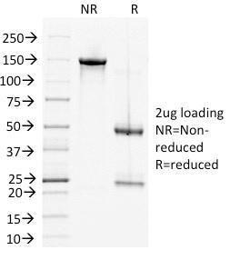 SDS-PAGE analysis of Anti-Desmoglein 2 Antibody [6D8] under non-reduced and reduced conditions; showing intact IgG and intact heavy and light chains, respectively. SDS-PAGE analysis confirms the integrity and purity of the antibody