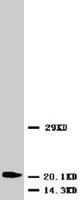 Anti-ENO2 Rabbit Polyclonal Antibody