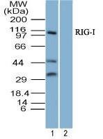 Anti-DDX58 Rabbit Polyclonal Antibody