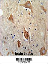 Anti-FGFBP3 Rabbit Polyclonal Antibody (FITC (Fluorescein Isothiocyanate))