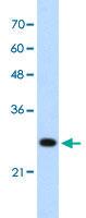 Anti-FOXR2 Rabbit Polyclonal Antibody