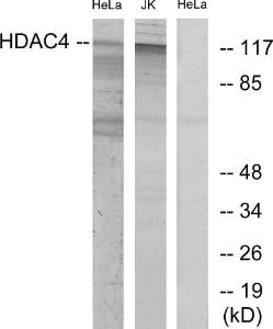 Western blot analysis of lysates from HeLa and Jurkat cells using Anti-HDAC4 Antibody. The right hand lane represents a negative control, where the antibody is blocked by the immunising peptide