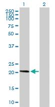 Anti-AP3S1 Mouse Polyclonal Antibody