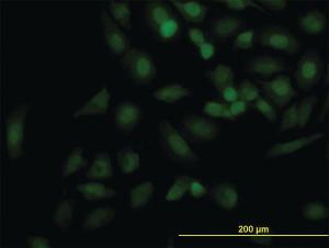 Anti-KIF2C Mouse Monoclonal Antibody [clone: 1G2]