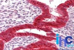 Anti-DDX58 Rabbit Polyclonal Antibody