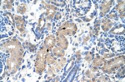 Anti-FOXR2 Rabbit Polyclonal Antibody