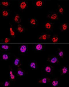 Anti-HDAC1 antibody