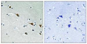 Immunohistochemical analysis of paraffin-embedded human brain using Anti-MAP2K7 (phospho Ser271) Antibody. The right hand panel represents a negative control, where the Antibody was pre-incubated with the immunising peptide