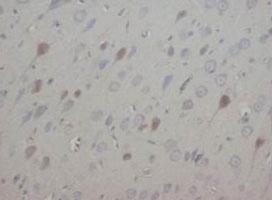 Anti-ENO2 Rabbit Polyclonal Antibody