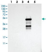 Anti-CYP2C19 Rabbit Polyclonal Antibody