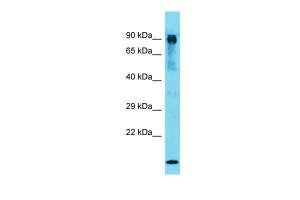 Anti-MUT Rabbit Polyclonal Antibody