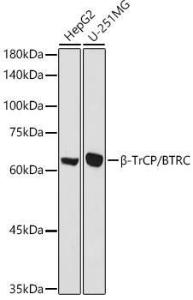 Western blot analysis of extracts of various cell lines, using Anti-Beta TRCP / HOS Antibody (A307151) at 1:1,000 dilution. The secondary antibody was Goat Anti-Rabbit IgG H&L Antibody (HRP) at 1:10,000 dilution.