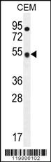 Anti-TBC1D13 Rabbit Polyclonal Antibody