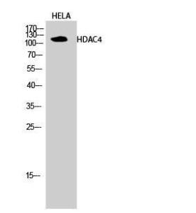 Western blot analysis of HELA cells using Anti-HDAC4 Antibody