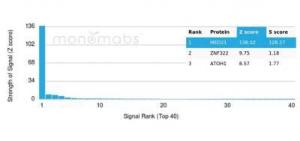 Analysis of protein array containing more than 19,000 full-length human proteins using Anti-MED21 Antibody [PCRP-MED21-4B5] Z-Score and S- Score