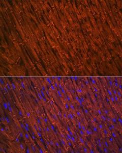 Immunofluorescence analysis of rat heart using Anti-Desmin Antibody [ARC0235] (A305689) at a dilution of 1:100 (40X lens). DAPI was used to stain the cell nuclei (blue)