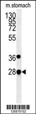 Anti-PREPL Rabbit Polyclonal Antibody