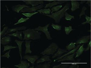 Anti-PML Mouse Monoclonal Antibody [clone: 2B10]