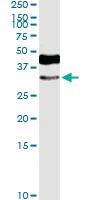 Anti-HOXD8 Rabbit Polyclonal Antibody