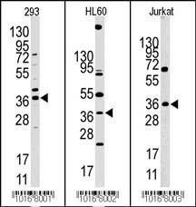 Anti-HIF1AN Rabbit Polyclonal Antibody (Biotin)