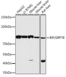 Western blot analysis of extracts of various cell lines, using Anti-GRP78 BiP Antibody (A12567) at 1:1000 dilution. The secondary Antibody was Goat Anti-Rabbit IgG H&L Antibody (HRP) at 1:10000 dilution. Lysates/proteins were present at 25 µg per lane