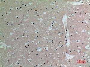 Immunohistochemical analysis of paraffin-embedded human brain using Anti-IL16 Antibody