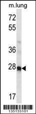 Anti-HOXA4 Rabbit Polyclonal Antibody (FITC (Fluorescein Isothiocyanate))