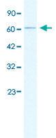 Anti-GABRD Rabbit Polyclonal Antibody