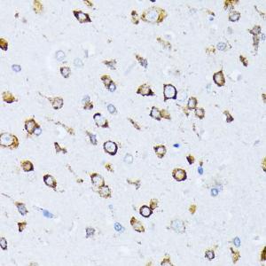 Immunohistochemistry analysis of paraffin-embedded rat brain using Anti-GRP78 BiP Antibody (A12567) at a dilution of 1:100 (40X lens). Perform microwave antigen retrieval with 10 mM PBS buffer pH 7.2 before commencing with IHC staining protocol