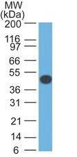 Antibody anti-cytokeratin 18 DA7 100 µg