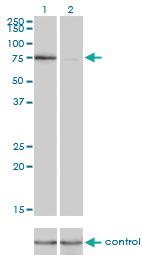 Anti-KIF2C Mouse Monoclonal Antibody [clone: 1G2]