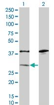 Anti-SULT1A1 Mouse Monoclonal Antibody [clone: 1F8]