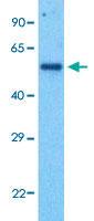 Anti-GABRD Rabbit Polyclonal Antibody