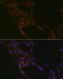 Anti-SMURF 2 Rabbit Monoclonal Antibody [clone: ARC1897]