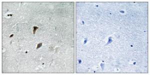 Immunohistochemical analysis of paraffin-embedded human brain using Anti-MAP2K3 (phospho Thr222) Antibody The right hand panel represents a negative control, where the antibody was pre-incubated with the immunising peptide