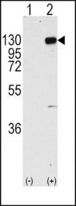 Anti-FGFR1 Rabbit Polyclonal Antibody (APC (Allophycocyanin))