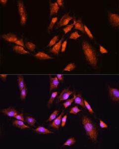 Immunofluorescence analysis of C6 cells using Anti-Beta TRCP / HOS Antibody (A307151) at a dilution of 1:100. DAPI was used to stain the cell nuclei (blue).