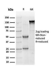 SDS-PAGE analysis of Anti-SOX10 Antibody [PCRP-SOX10-1D8] under non-reduced and reduced conditions; showing intact IgG and intact heavy and light chains, respectively. SDS-PAGE analysis confirms the integrity and purity of the antibody