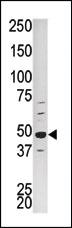 Anti-CDK16 Rabbit Polyclonal Antibody