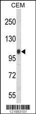 Anti-ITGB3 Rabbit Polyclonal Antibody