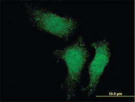 Anti-RUVBL1 Mouse Monoclonal Antibody [clone: 3G4-1F8]