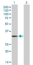 Anti-CCDC108 Mouse Polyclonal Antibody