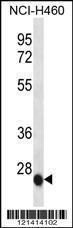 Anti-IL6 Rabbit Polyclonal Antibody (AP (Alkaline Phosphatase))